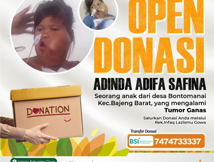 Adinda Adifa Safina, seorang anak yang tengah berjuang melawan kanker tumor ganas. Foto (Ist).